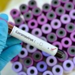 US Plans for Vital Increase of Coronavirus Testing 9