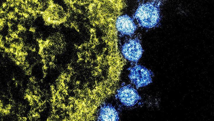 COVID-19: How A Coronavirus Broke The System 1