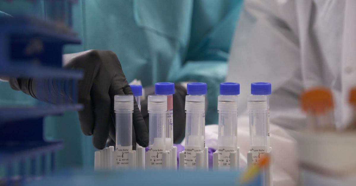 Finding a coronavirus vaccine and drug 1