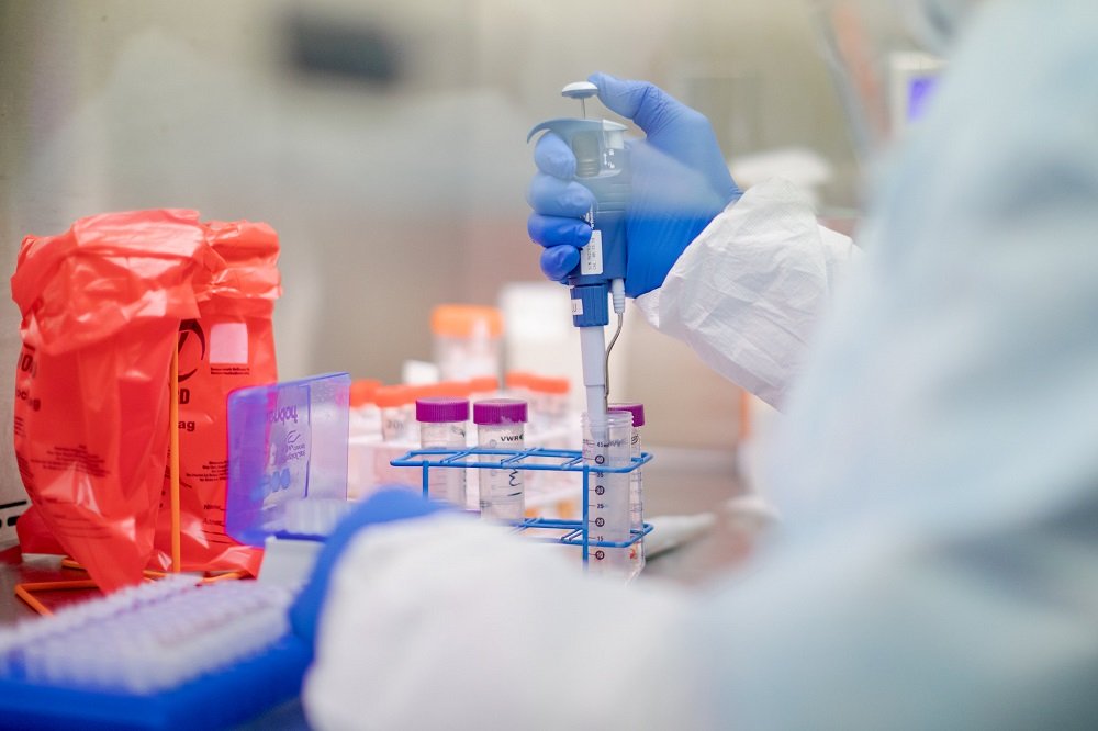 Coronavirus Is The World’s Biggest Stress Test Since World War II 1