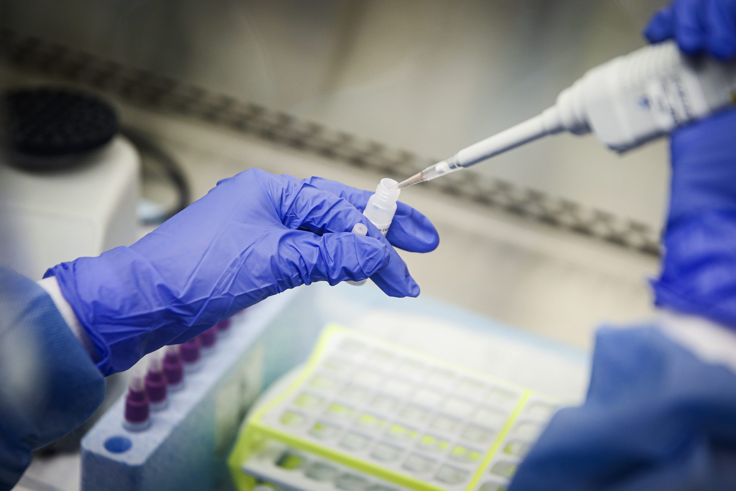 Coronavirus: Combination of antimalarial medication and antibiotics could shorten COVID-19, researchers say 1