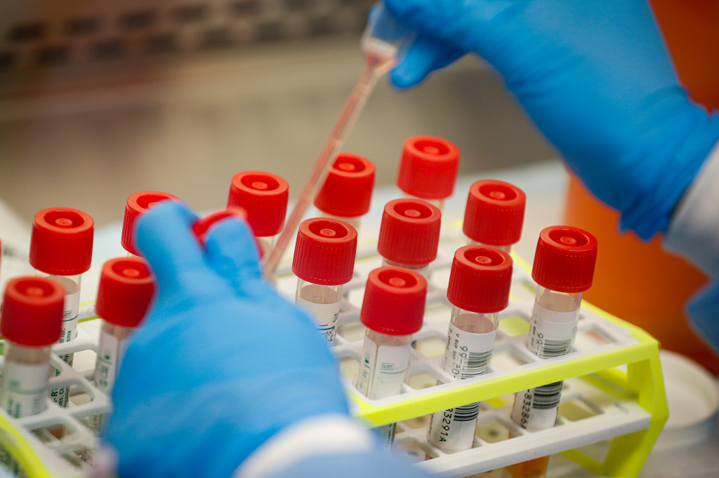 Do Colorado hospitals get extra money for coronavirus cases
and deaths? Yes and no. 1