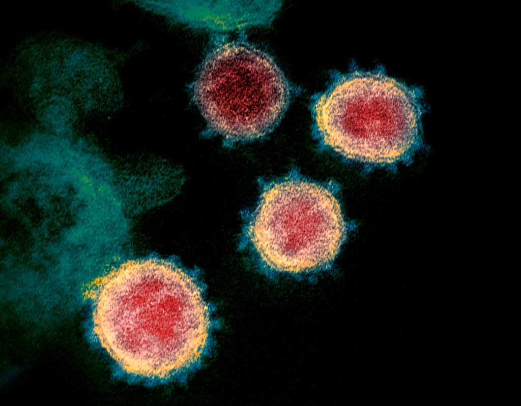 Two more coronavirus deaths announced in Colorado as state total rises to 9 1