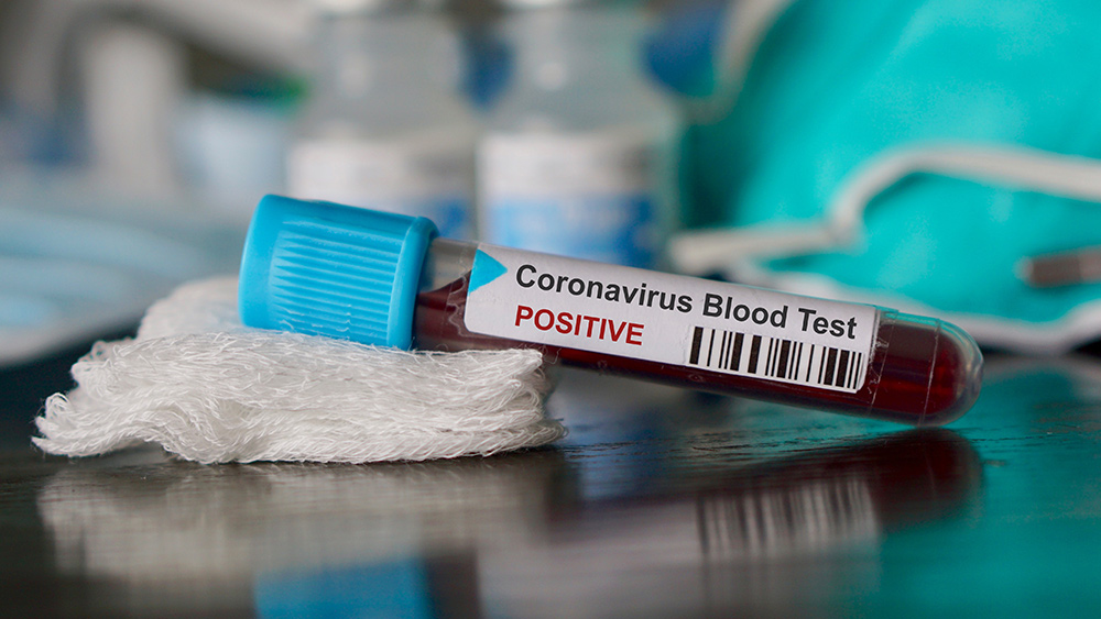 New study says people with blood type A more likely to catch the coronavirus 1
