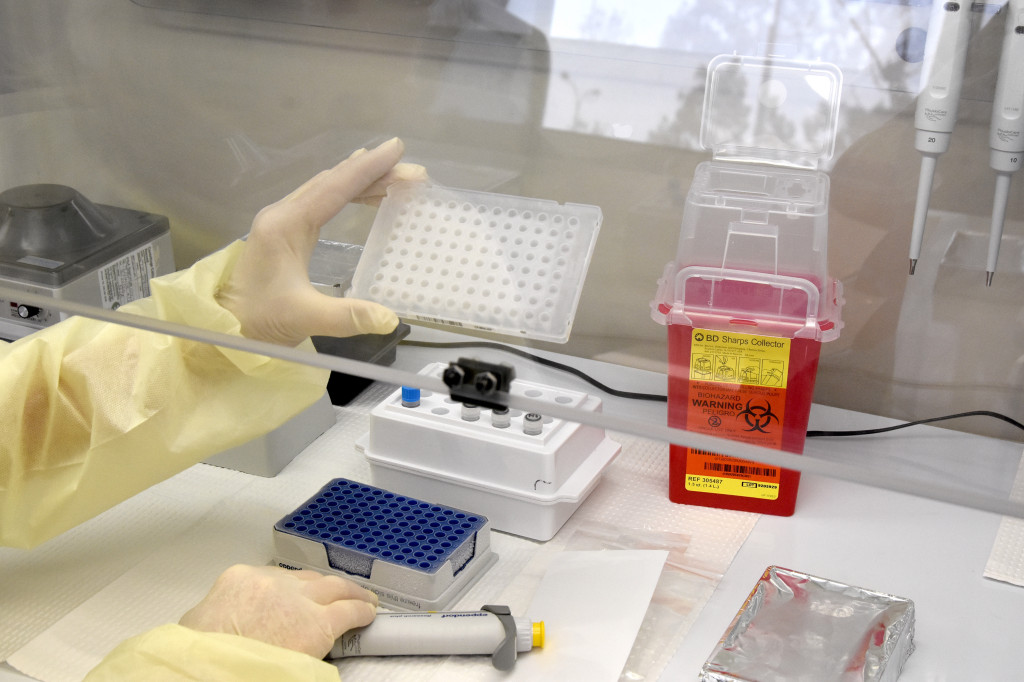 Orange County reports first coronavirus death as total cases hit 152 1