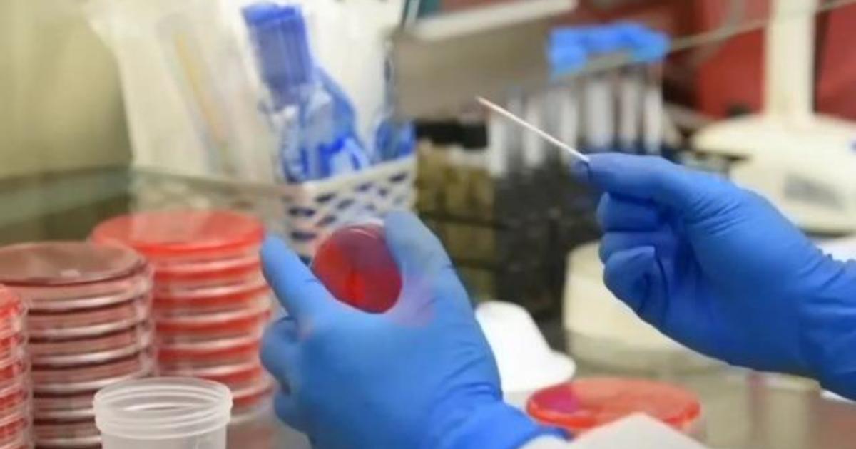 Eye Opener: U.S. becomes global coronavirus epicenter 1