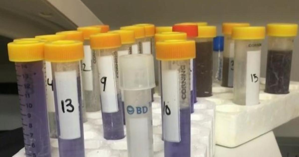 Federal government looks to malaria drug as possible coronavirus treatment 1
