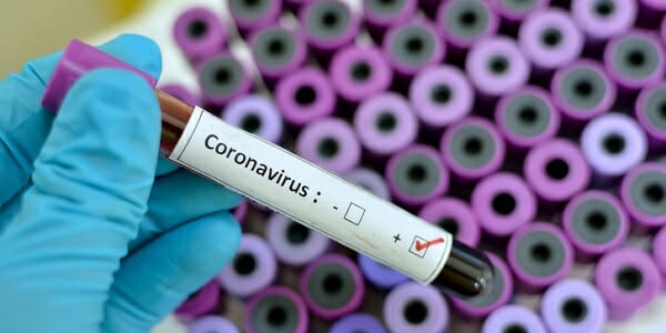 New U.S. coronavirus cases spike as more tests are completed 1