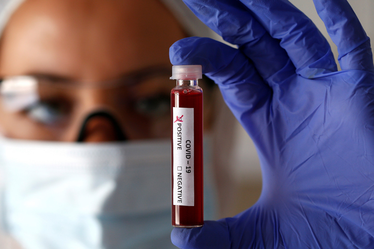 Mount Sinai researchers develop test for coronavirus antibodies 1