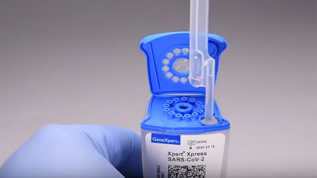 FDA approves new coronavirus test that can have 'results within hours' instead of days 1 FDA approves new coronavirus test that can have 'results within hours' instead of days 1