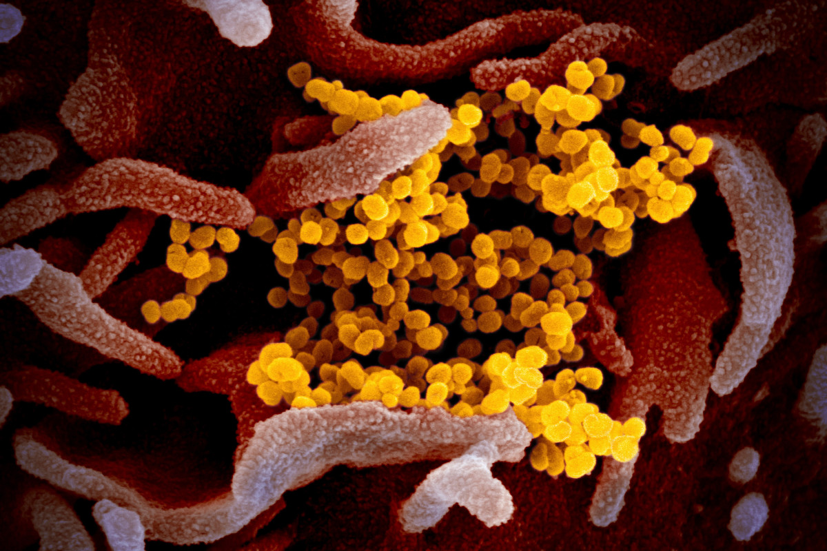 Astrophysicist hospitalized while trying to invent coronavirus device 1