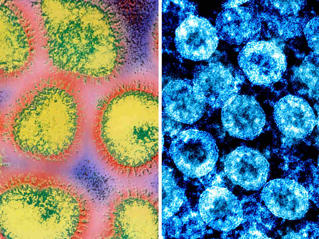 How The Novel Coronavirus And The Flu Are Alike ... And Different 1