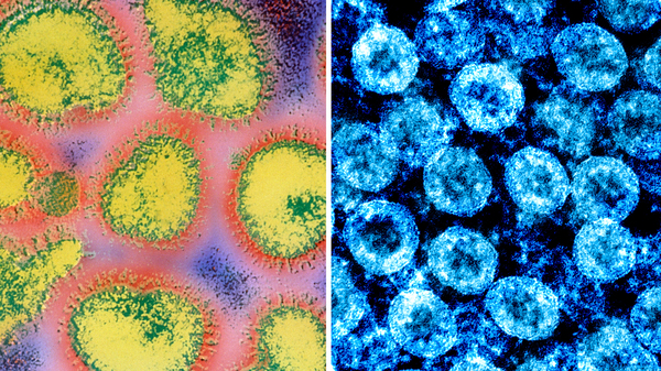How The Novel Coronavirus And The Flu Are Alike ... And Different 1