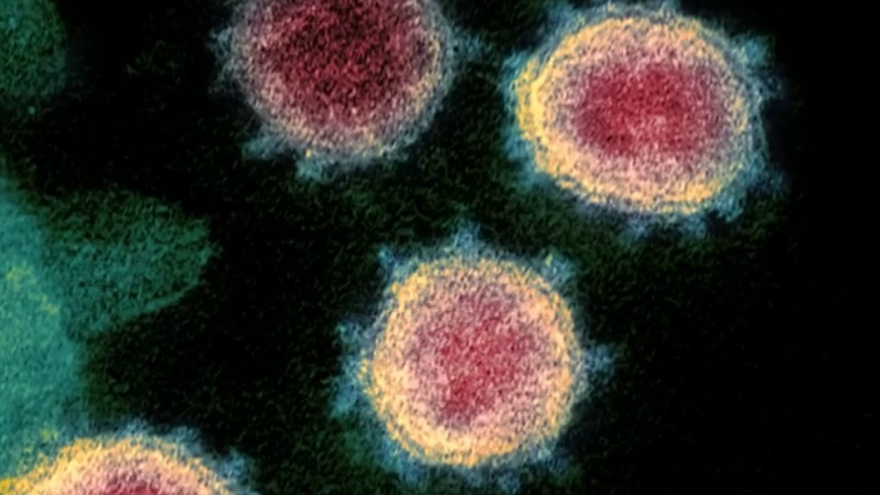 Risk of 'deadly' cyberattack looms amid coronavirus outbreak 1