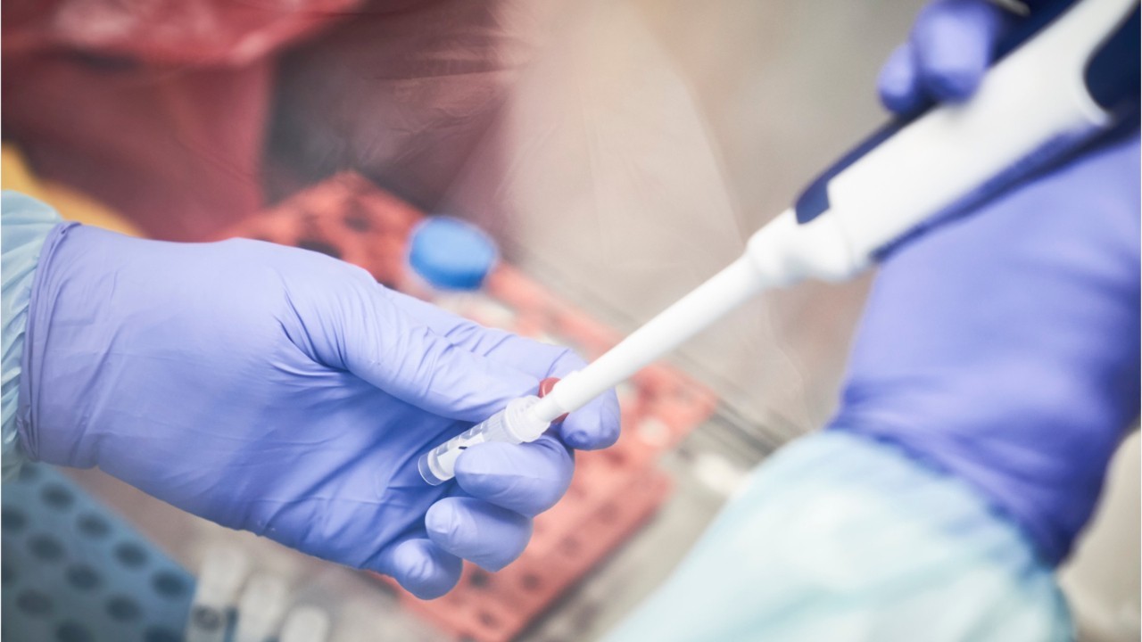 There's drug combo to shorten coronavirus, French researchers say 1