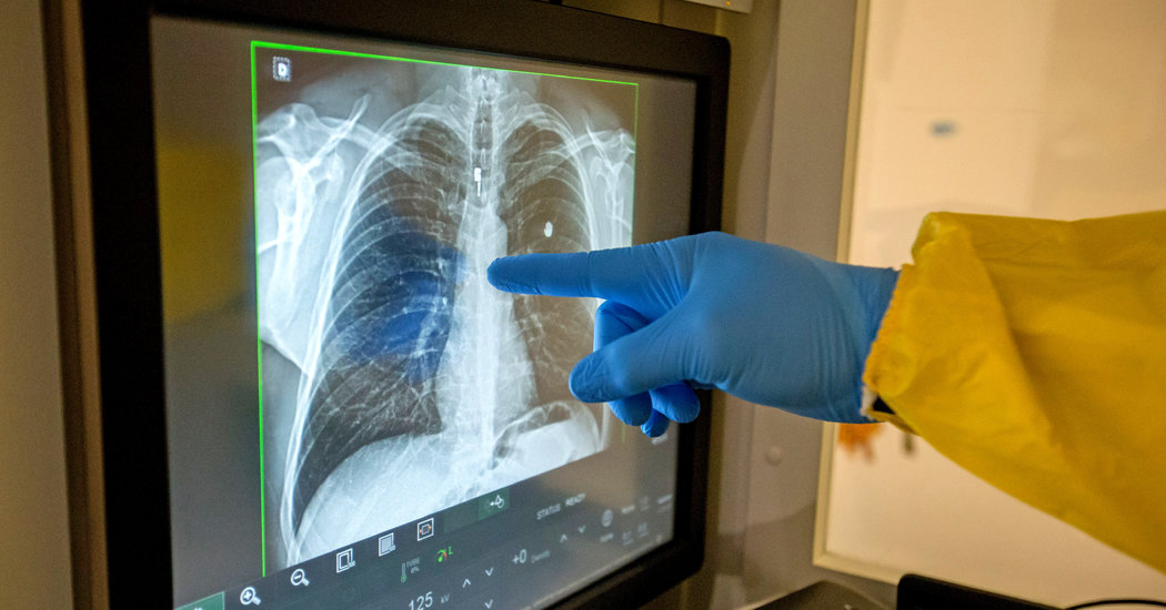 Recovering From the Coronavirus, This Doctor Can Breathe Again 1
