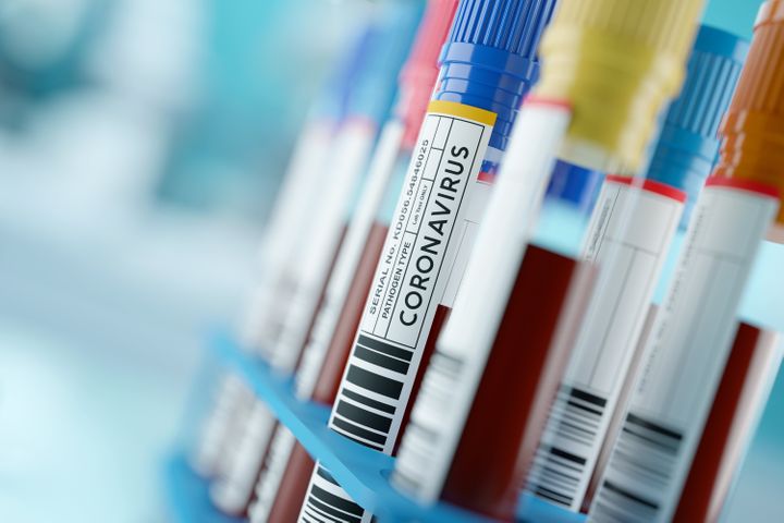 What Is A Coronavirus Antibody Test And What Does It
Reveal? 1