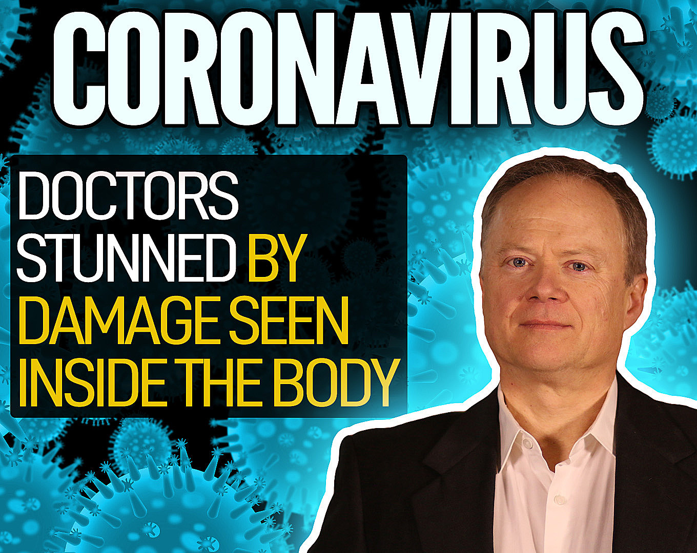 Coronavirus: Doctors Stunned By Damage Seen Inside The
Body 1