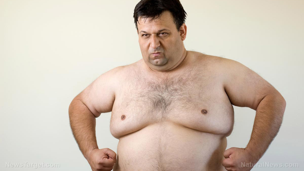 Huge new study finds that obesity is the single biggest "chronic" factor in hospitalizations for COVID-19 in NYC, which explains why America is getting hit HARD 1