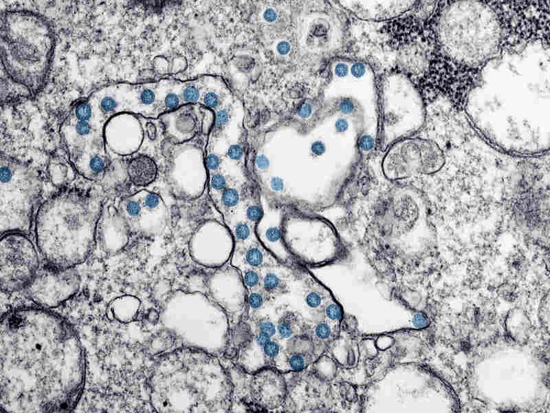 New York Starts 'Aggressive' Coronavirus Antibody Testing In
Quest To Reopen Economy 1