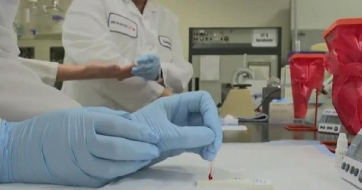 Regeneron CSO discusses possible timeline for COVID-19 treatment 1