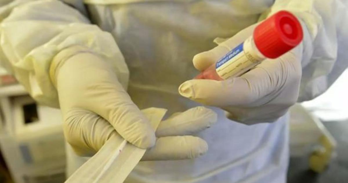 White House blueprint for coronavirus testing relies on
states 1