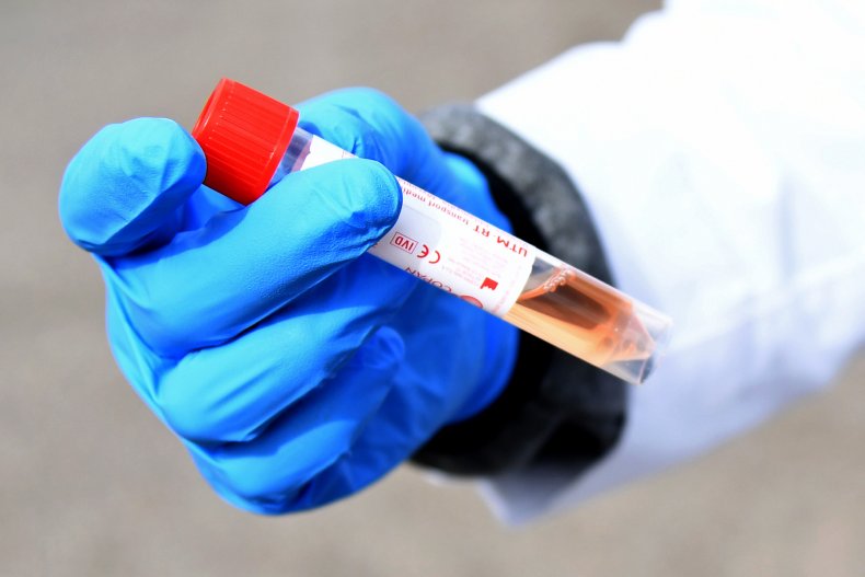 U.K. Says Millions of Coronavirus Test Kits Bought From China Are Unreliable for Most Patients 1