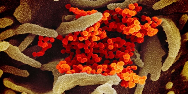 Indian healer who kissed hands to cure coronavirus dies of
coronavirus 1