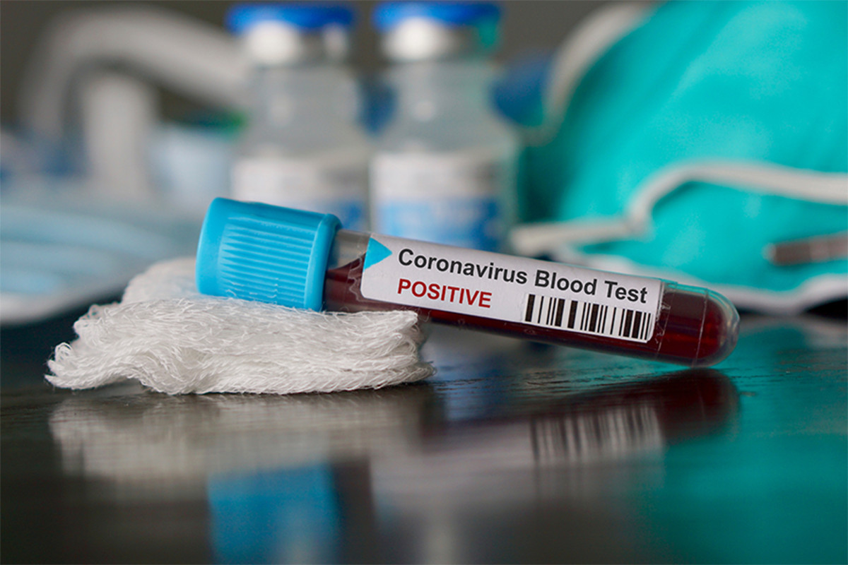 Possible coronavirus vaccine enters human testing trial at
‘unprecedented speed’ 1