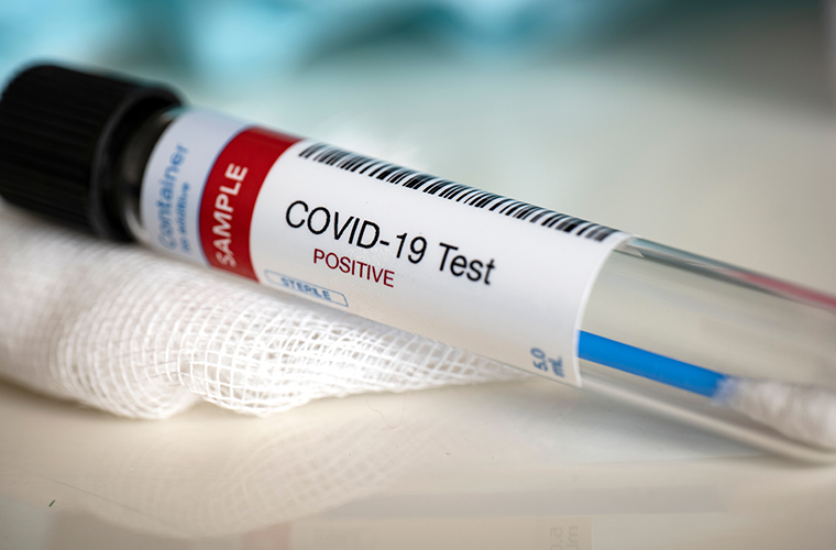 Coronavirus Update – May 10: Cases near 33.5k; testing
expands; Goodwill to reopen stores 1