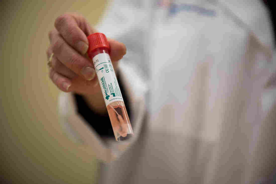 Why The Warning That Coronavirus Was On The Move In U.S.
Cities Came So Late 1