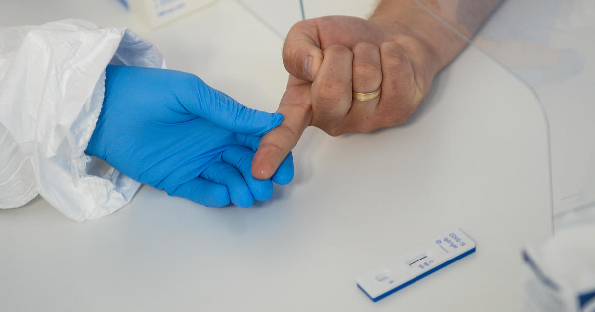 Challenge continues to find accurate coronavirus antibody
tests 1