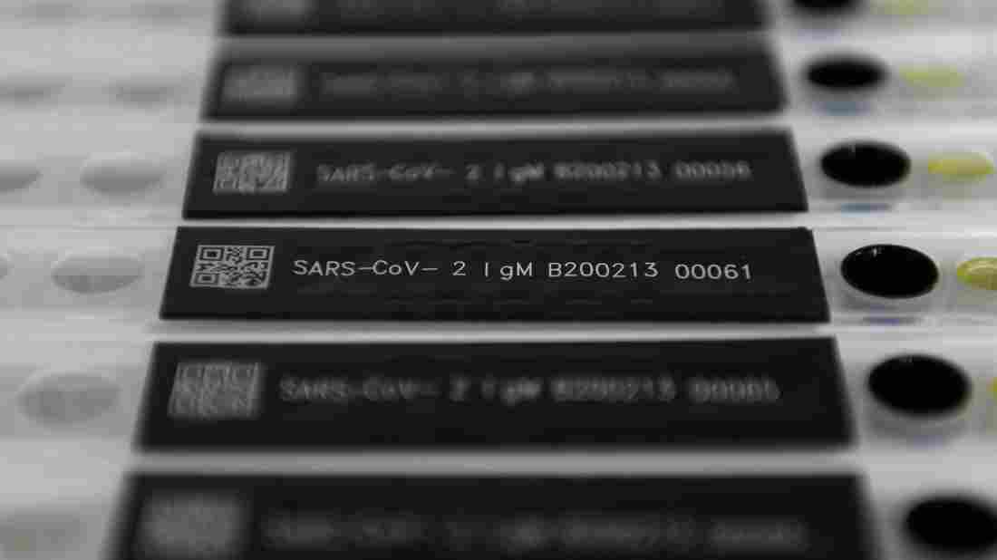 'No Evidence' That Recovered COVID-19 Patients Are Immune,
WHO Says 1 'No Evidence' That Recovered COVID-19 Patients Are Immune,
WHO Says 1