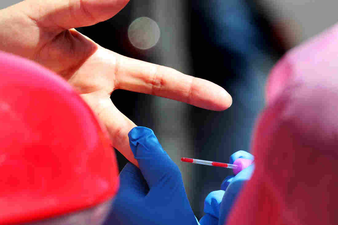 Antibody Tests For Coronavirus Can Miss The Mark 1
