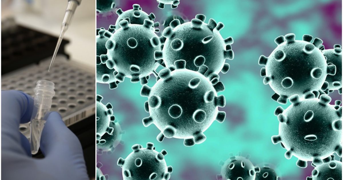 CLOWNWORLD: Imported Coronavirus Testing Kits Found to be Contaminated with Coronavirus 1