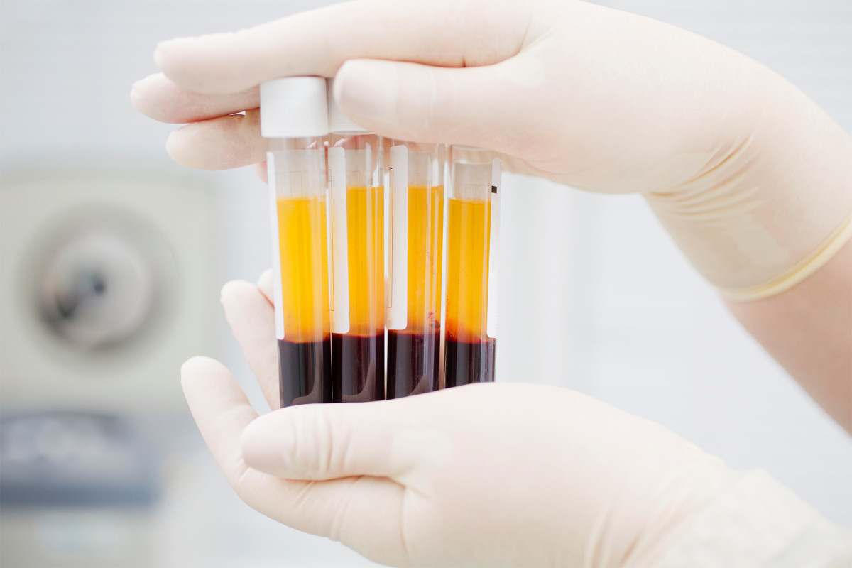 Researchers able to test if blood plasma of coronavirus survivors can protect health care workers 1