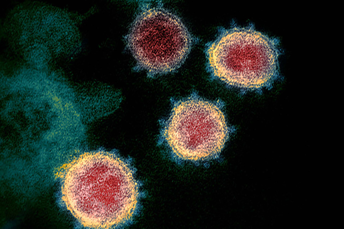Food contamination probably not a factor in coronavirus, experts believe 1