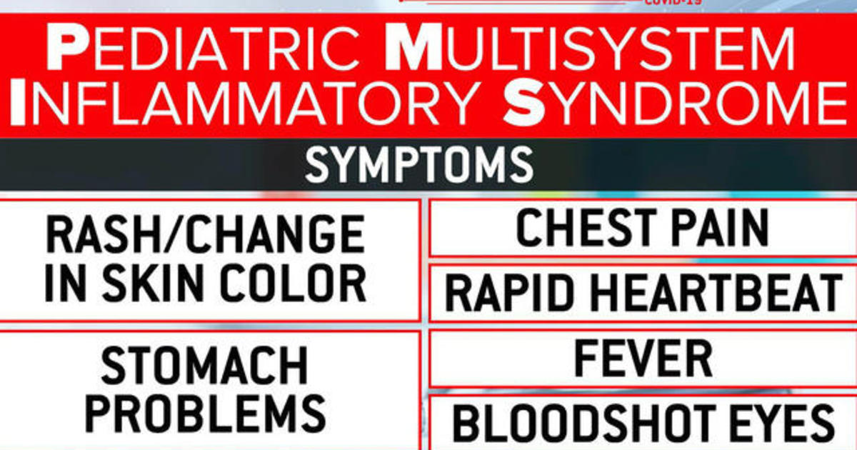 New clues in mysterious illness potentially linked to
COVID-19 in children 1