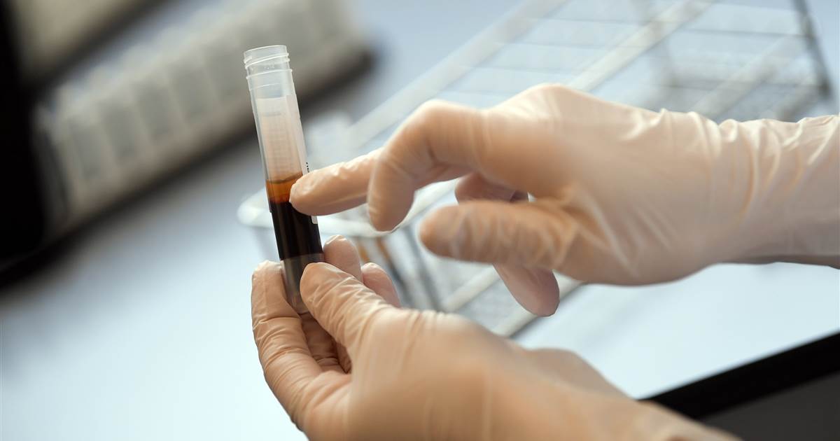 Gay men restricted from donating plasma to U.K. coronavirus
trials 1