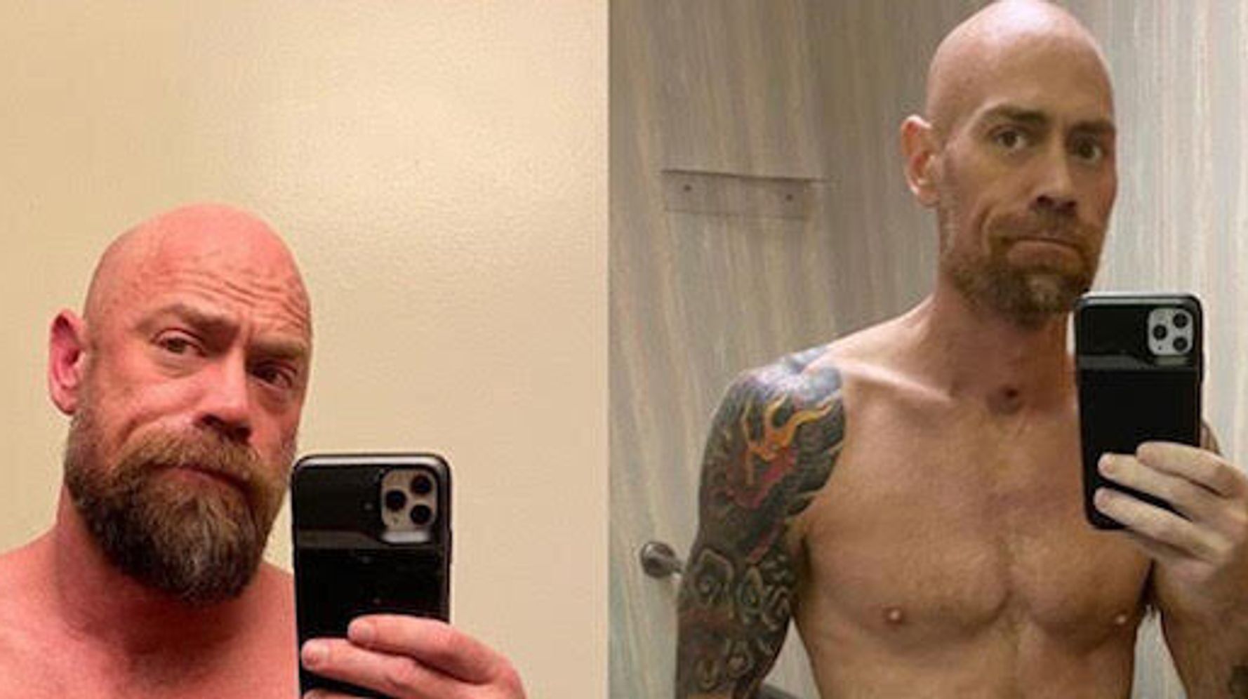Nurse Who Survived COVID-19 Shares Jaw-Dropping Photo Of
What It Did To His Body 1