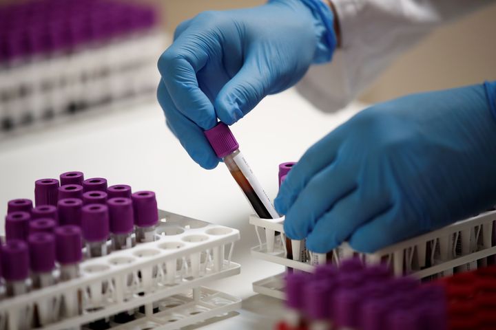 COVID-19 Antibody Tests Can Be Wrong Half The Time, CDC
Says 1