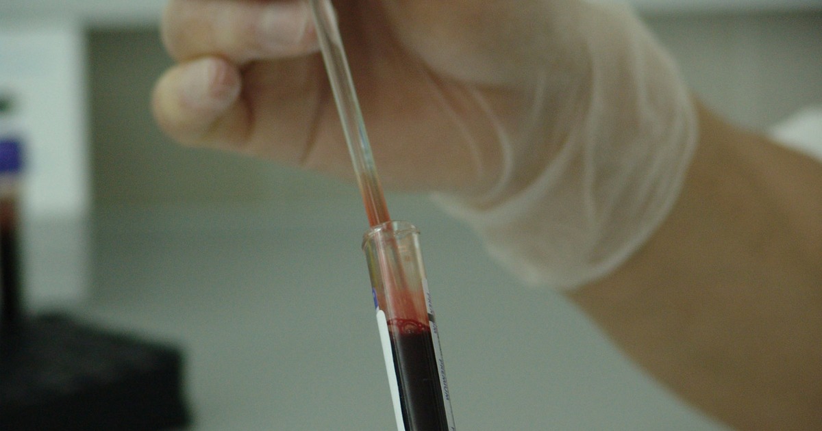 Blood of ‘Recovered COVID-19 Patients’ Sold for $14K on
Darknet as Cure 1