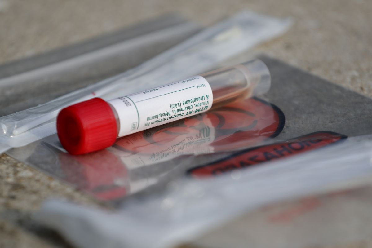 FDA suspends coronavirus testing program backed by Bill
Gates 1