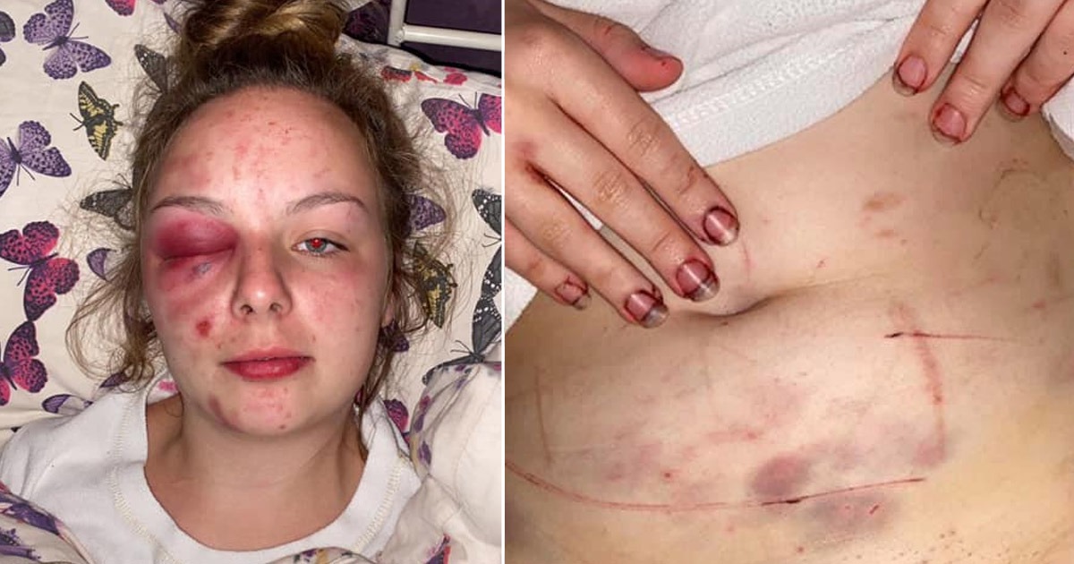 REPORT: Girl Tortured, Sexually Abused by Grooming Gang for
Refusing Sex During COVID-19 Quarantine 1