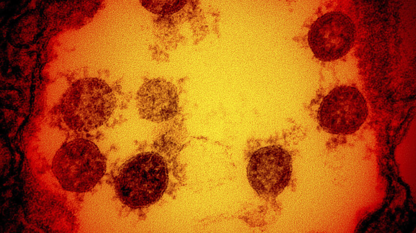 CDC analysis now suggests coronavirus started spreading in
the U.S in January 1