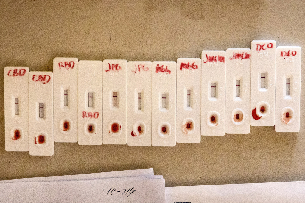 CDC: Coronavirus antibody tests could be wrong 50% of the
time 1