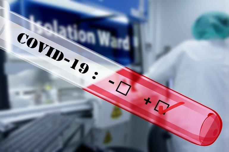 Should You Get Tested For COVID-19? 1