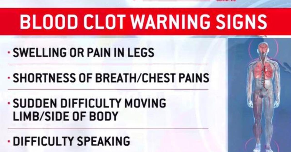 Doctors warn of potentially deadly blood clots in COVID-19
patients 1