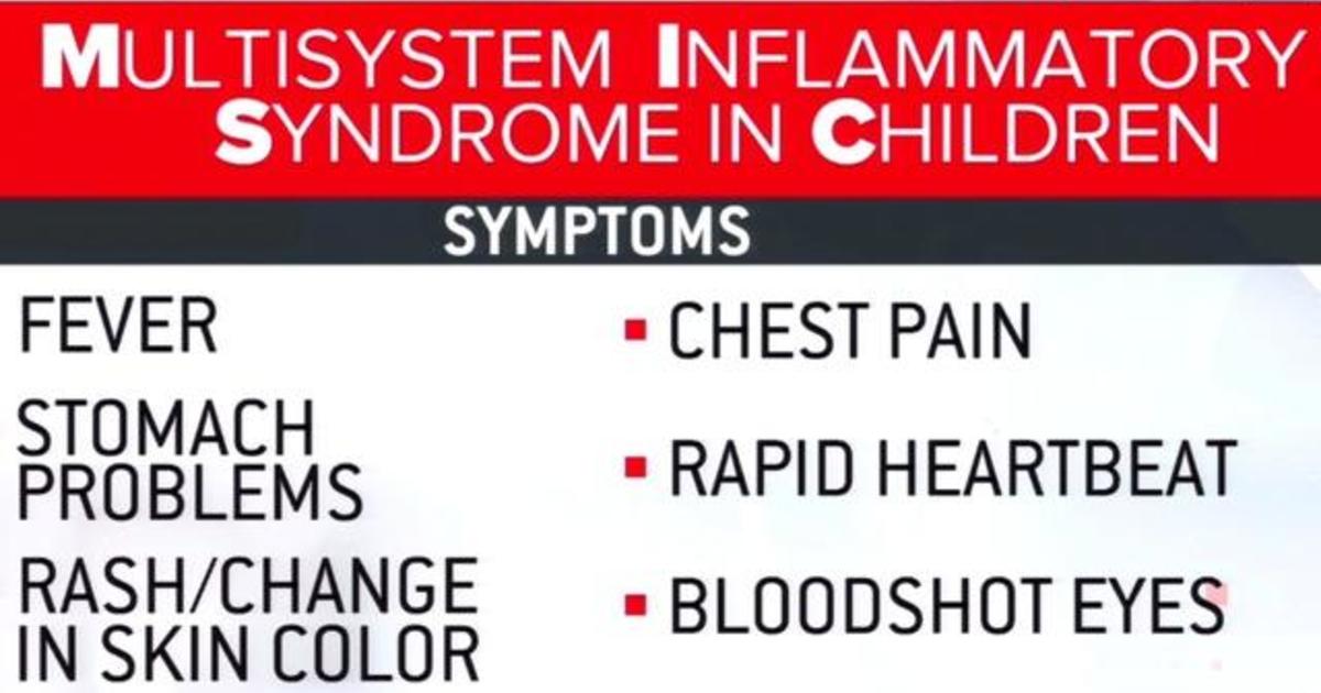 Mystery illness in kids associated with COVID-19 being
reported in young adults 1