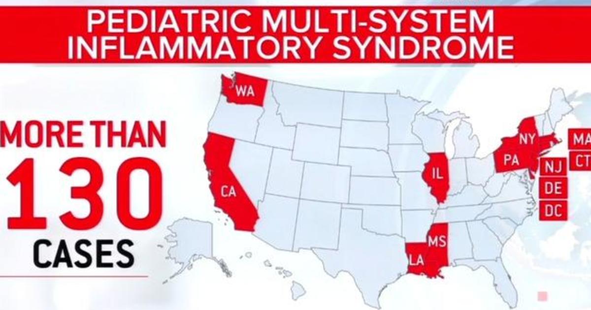 Over 130 kids hospitalized nationwide with conditions
related to coronavirus 1